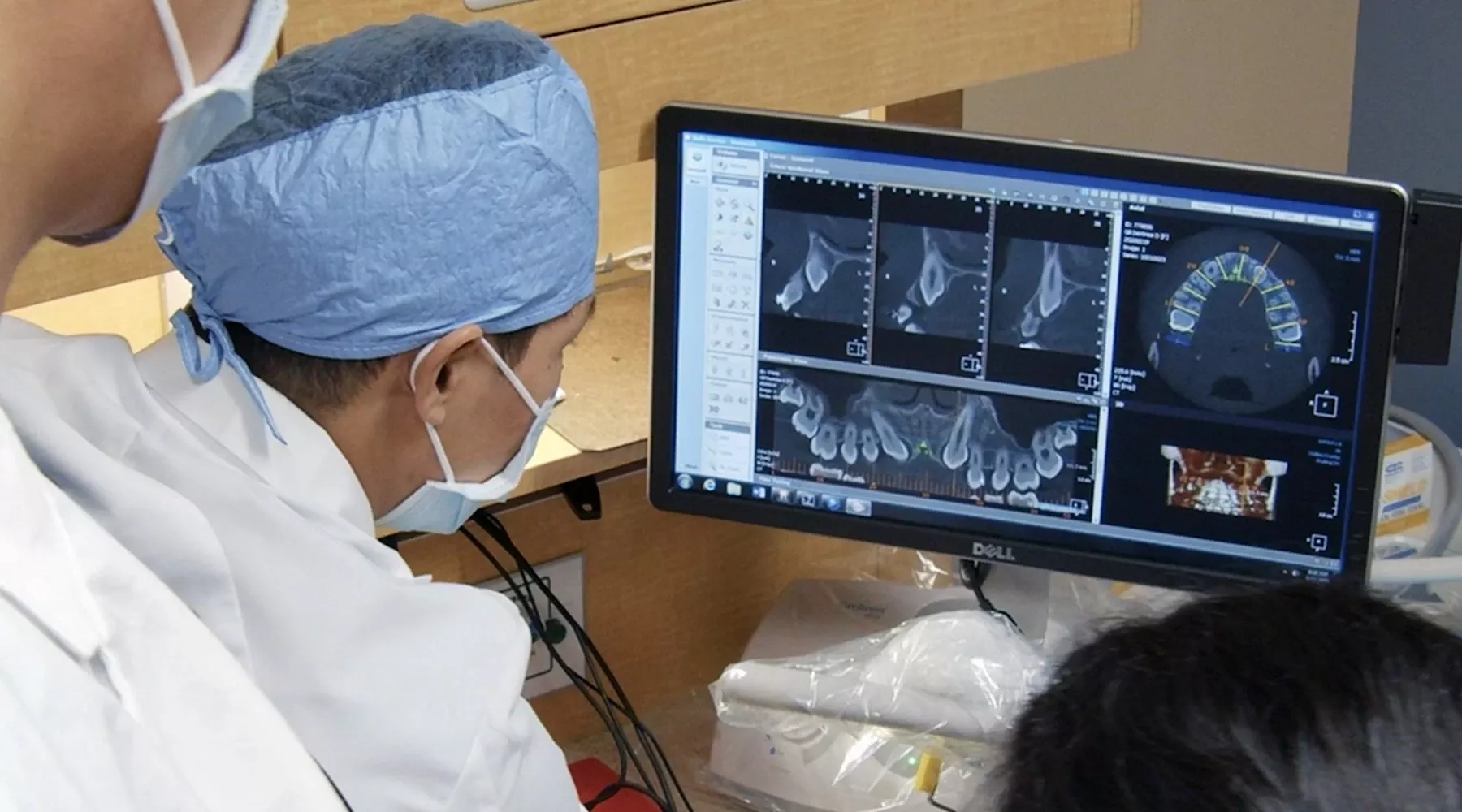 Dentist looks at computer screen showing various angles of digital dental X-rays
