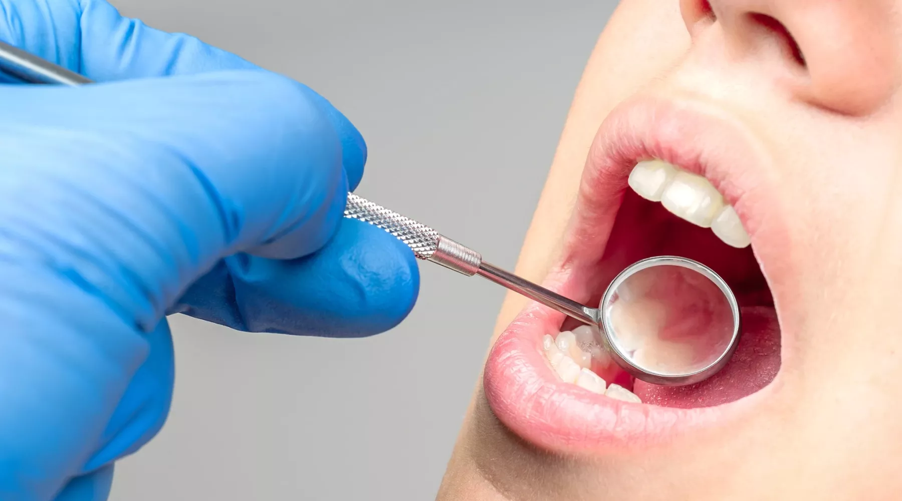 Closeup of dental exam